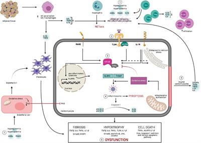 Mechanisms and Therapeutic Prospects of Diabetic Cardiomyopathy Through the Inflammatory Response